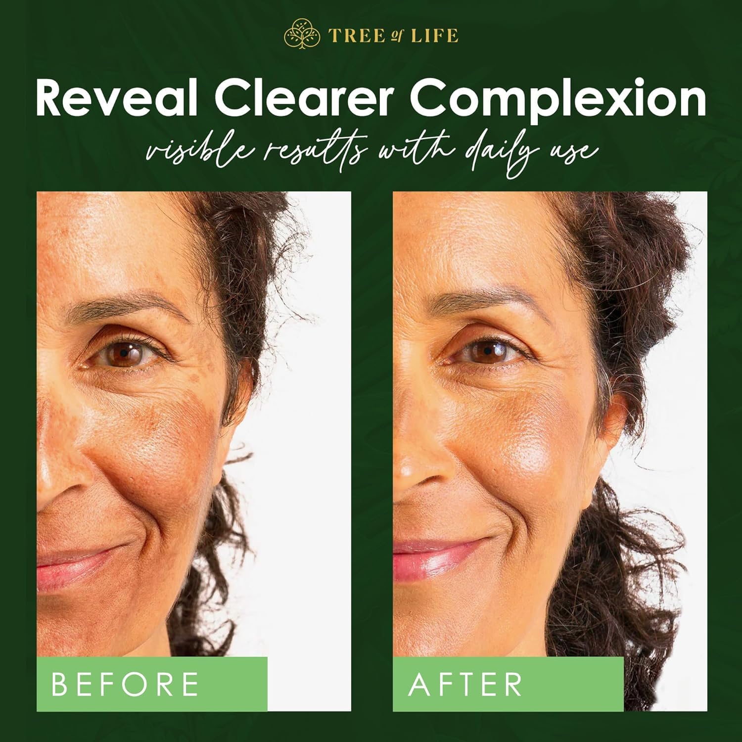 Niacinamide Vitamin B3 Serum, Hydrating Face Oil for Dark and Age Spots, Tightens Pores, Facial Serums for Sensitive Skin Care with Hyaluronic Acid and Vitamin E, 2 Fl Oz