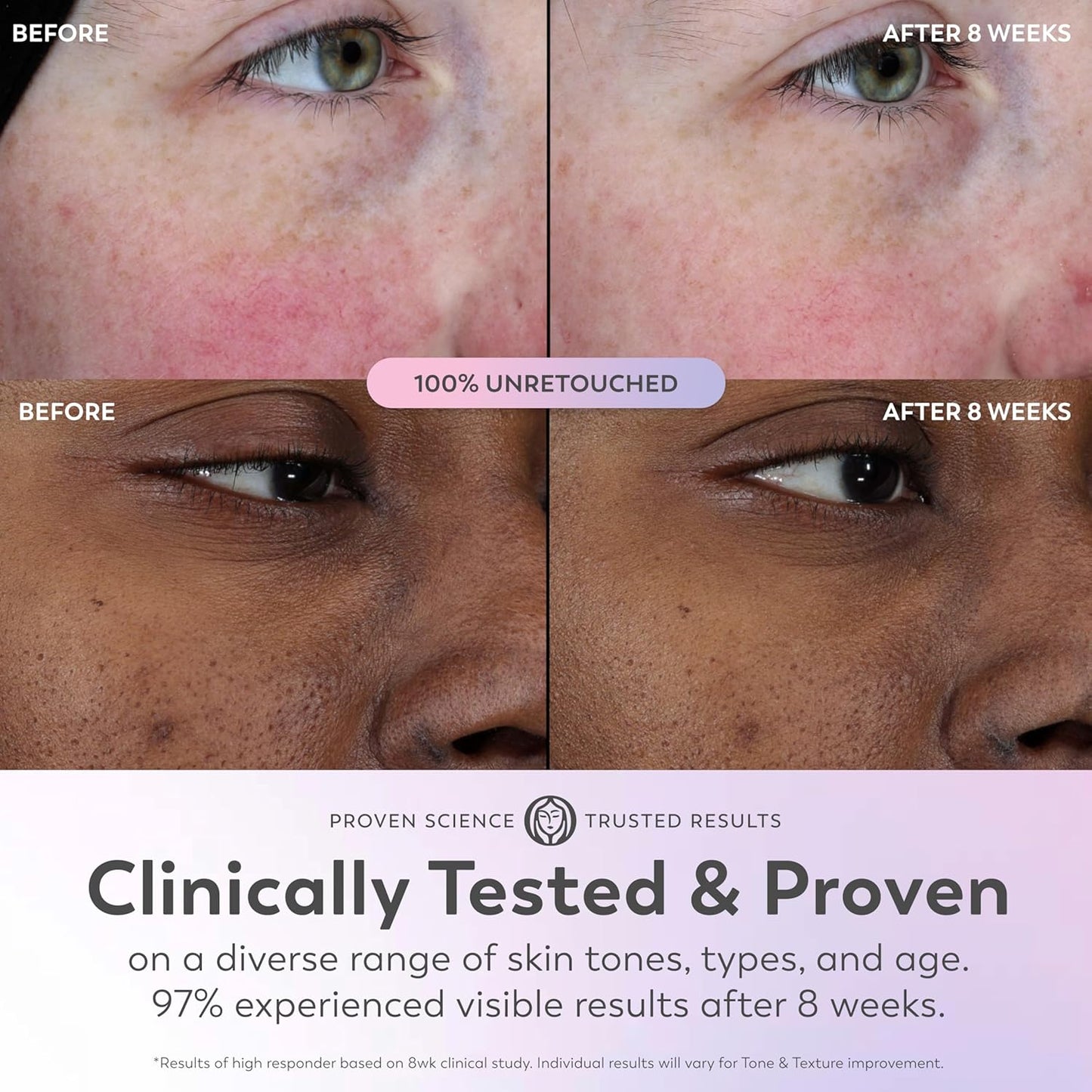 Super Serum - Niacinamide, Vitamin C & E, Collagen Peptide, AHA - 5-In-1 Skin Care Benefits for Face - Healthy Glow, Brightening, Hydrating, Smoothing, Firming, Evens Tone, Anti-Aging, 1.0 Oz