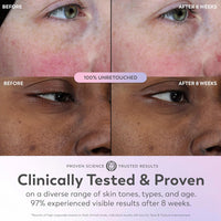 Super Serum - Niacinamide, Vitamin C & E, Collagen Peptide, AHA - 5-In-1 Skin Care Benefits for Face - Healthy Glow, Brightening, Hydrating, Smoothing, Firming, Evens Tone, Anti-Aging, 1.0 Oz