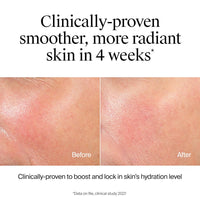 Hydro Boost Hydrating Face Wash & Makeup Remover, Gentle Facial Cleanser Gel with Hyaluronic Acid, Locks Moisture for Soft Supple Skin, Hypoallergenic, Oil-Free, Soap-Free, 7.8 Fl Oz