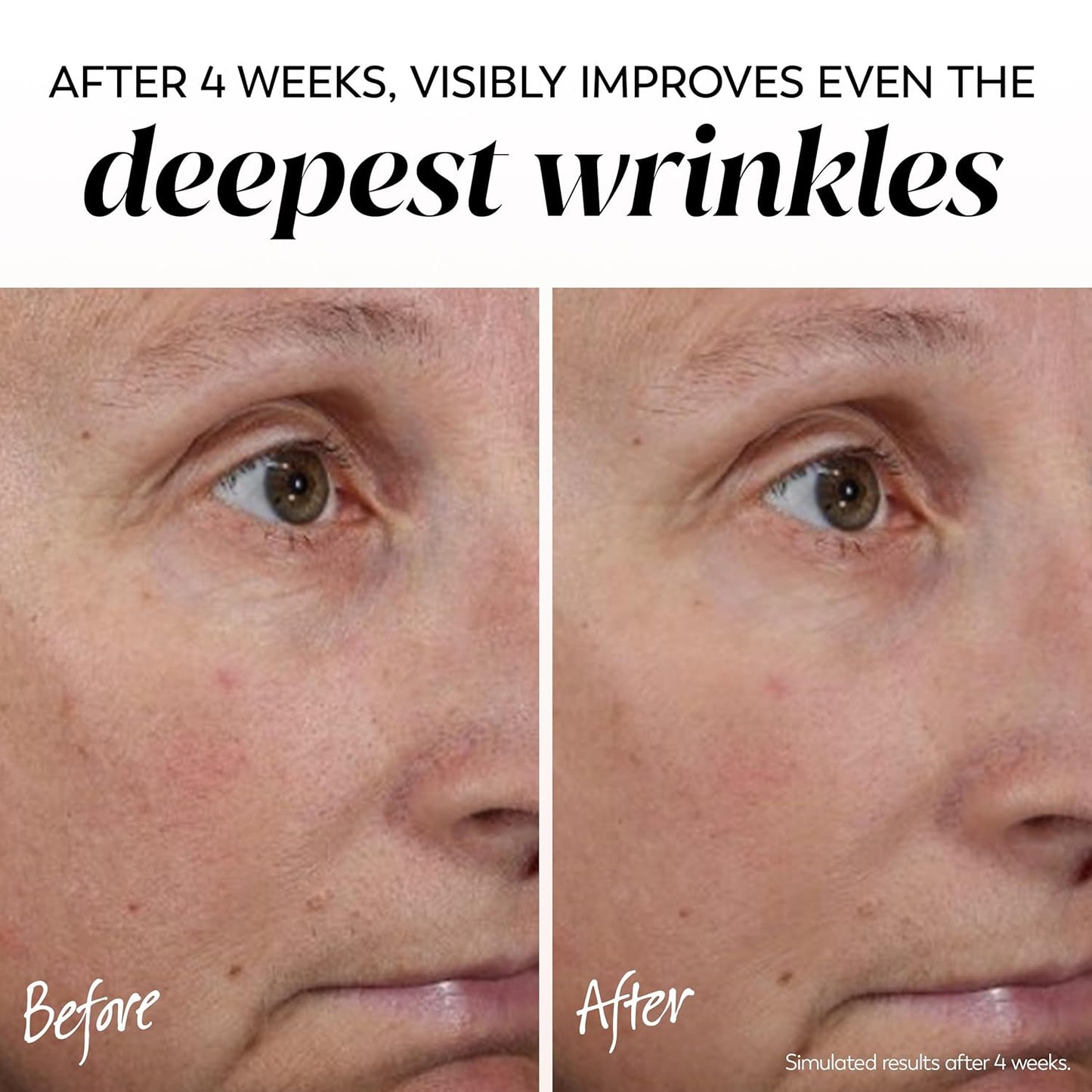 Face Moisturizer, Regenerist Micro-Sculpting Cream for Women, Fragrance-Free - Hydrating, Anti-Aging, Anti-Wrinkle, Firming Skin Care - Hyaluronic Acid, Niacinamide, Amino Peptides, 1.7 Oz