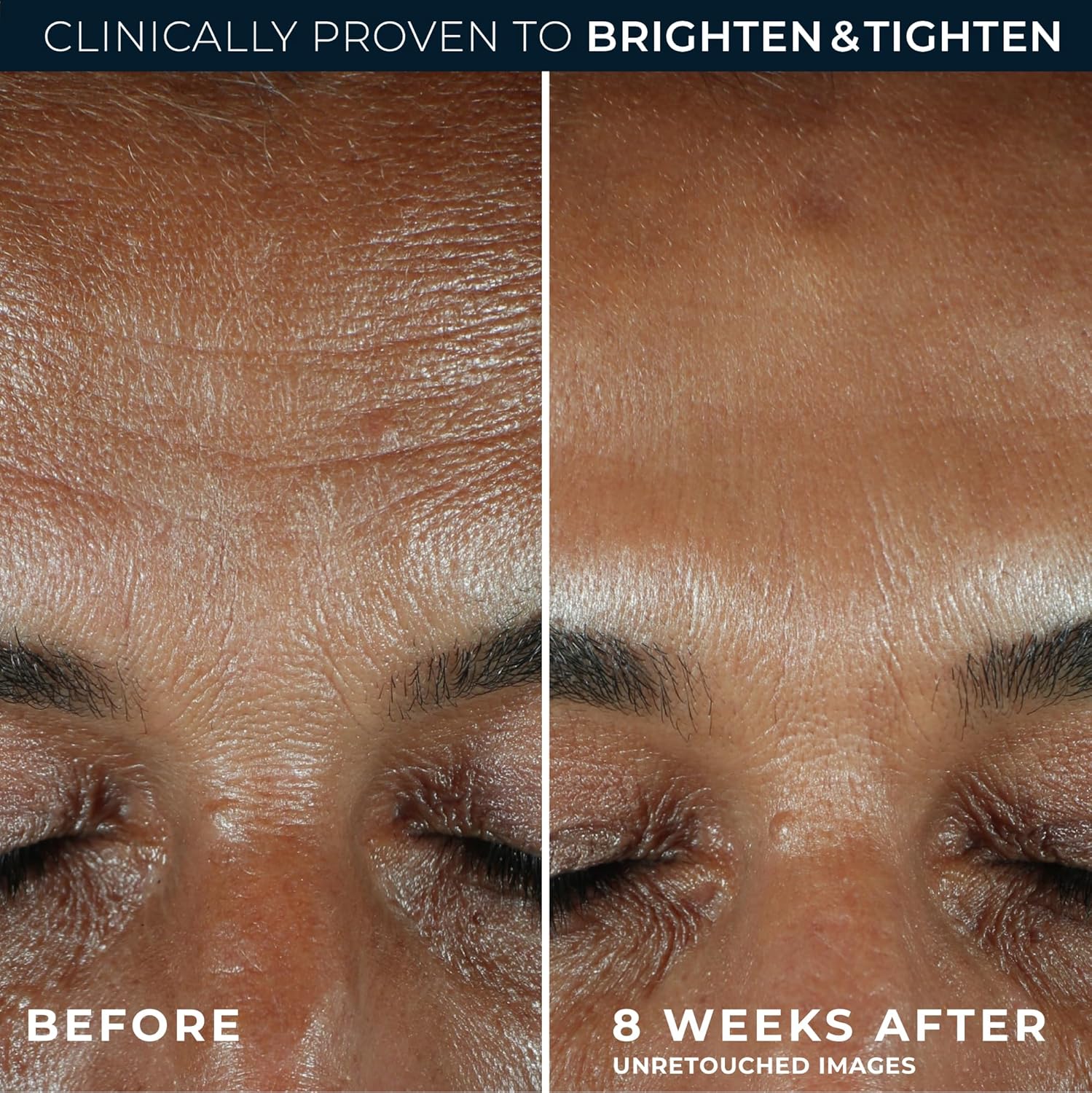 Multi Correxion Revive + Glow 10% Active Vitamin C Serum for Face, Daily Anti-Aging Wrinkle and Skin Tone Skin Care Treatment, Brightening Serum , 1 Fluid Ounce