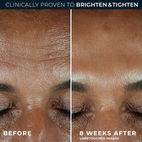 Multi Correxion Revive + Glow 10% Active Vitamin C Serum for Face, Daily Anti-Aging Wrinkle and Skin Tone Skin Care Treatment, Brightening Serum , 1 Fluid Ounce